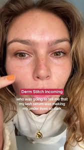 Lash Serums: Avoid Dark Circles with Safe Alternatives