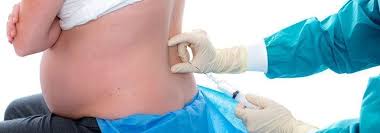 Pda bei der vaginalen geburt risiken der pda? Epiduralanasthesie Und Was Sie Daruber Wissen Sollten Gesunde Schwangerschaft