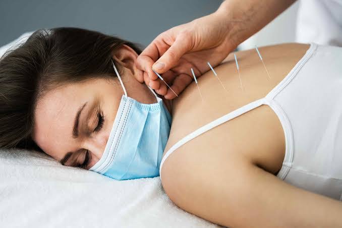 Dry Needle therapy product image