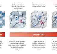 Singderm Dual CaHA Hybrid Filler Manufacturer Supplier ...