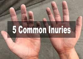 5 Common Injuries In Climbing And How To Prevent Them Send Edition In 2020 Hand Injuries Shoulder Injury Exercises Wrist Injury