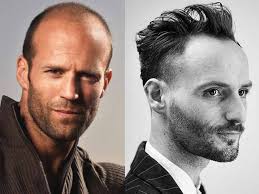 A gallery of men sporting different looks before and after a haircut, from fauxhawk to burr to shag to crew. Hairstyles For Men Big Foreheads Hera Hair Beauty
