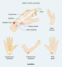 Wrist Pain: Causes, Symptoms, Treatments, And Diagnosis
