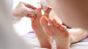 Image result for diabetic toes