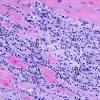From animal models of cardiac inflammation we have detailed insight of the strain specific immune. Https Encrypted Tbn0 Gstatic Com Images Q Tbn And9gcr Cgg0 Nvflknvet4ihauw1tm1s0pgbl1d Upymhzlfmy2phvk Usqp Cau