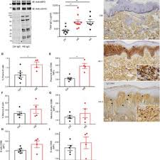The gathering online player rune andersen: Pdf Neutrophil Extracellular Traps B Cells And Type I Interferons Contribute To Immune Dysregulation In Hidradenitis Suppurativa