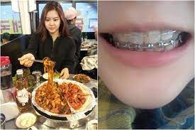 Kpop Idols Braces Kpop Idol Kpop Idol