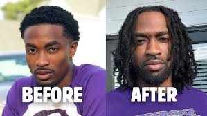 1 Month Loc Journey Update