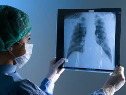 Keep in mind that the diagnosis may not come easily. Lung Cancer And Coughing Up Blood When To See A Doctor