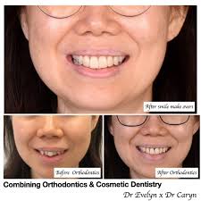 Evelyn Lee (@drevelynlgl) · London, England · Instagram photos and videos