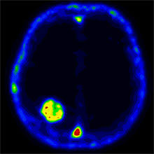 Monitoring Cell Death Could Help Cancer Treatment Mit Technology Review