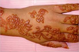 It is a painless process of tattooing. Ppd In Henna Tattoos Can Cause Allergic Reaction The New York Times
