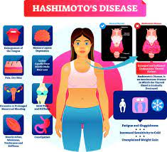 Middle is 18 months on natural desiccated thyroid. Hashimoto S Syndrome Symptoms Causes Treatments Centrespringmd