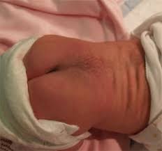 Back Newborn Nursery Stanford Medicine