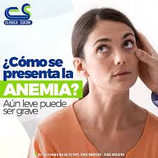 La anemia es una afección en la cual careces de suficientes glóbulos rojos  sanos para transportar un nivel adecuado de oxígeno a los tejidos del  cuerpo. La anemia, también conocida como nivel