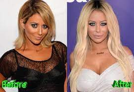 Aubrey o'day before and after: Aubrey O Day Plastic Surgery Pretty Big Changes For Aubrey