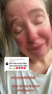 Replying to @Crystal Welsh