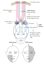 Easy Notes On Facial Nerve Learn In Just 4 Minutes