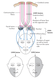 easy notes on facial nerve learn in just 4 minutes