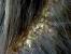 Scalp Psoriasis African American Hair