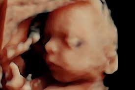 Fundraiser for Jordan Norris by Shannon O'Bryan : Healing baby boy Norris'  heart