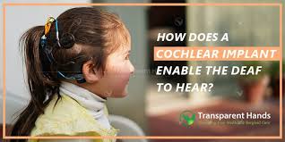 How much does a cochlear implant cost. Cochlear Implant Enable The Deaf To Hear Medical Procedures