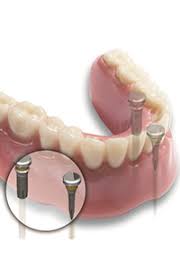 Find medical dentists near me. Medicaid Dentist Maryland Md Medicaid Dentist Near Me For Adults Nowdentistry