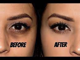 Conceal Dark Circles No Creasing Concealer For Dark Circles Covering Dark Circles Eye Cream For Dark Circles