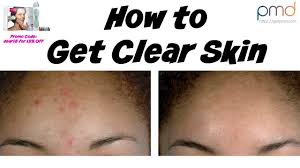 We did not find results for: How To Get Clear Skin Fast Pmd Clear Skin Tips Clear Skin Fast Clear Skin Diet