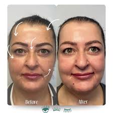 𝘕𝘪𝘬𝘬𝘪” 𝘊𝘩𝘳𝘪𝘴𝘵𝘪𝘯𝘢 𝘕𝘪𝘤𝘰𝘭𝘦 𝘌𝘷𝘢𝘯𝘴  (@nursenikki_aesthetics) • Instagram photos and videos