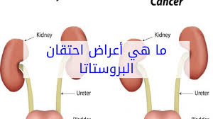 Infected men may experience pain or burning with urination, discharge from the penis, or testicular pain. Ù…Ø±Ø¶ Ø§Ù„Ø²Ù‡Ø±ÙŠ Ø¹Ù†Ø¯ Ø§Ù„Ø±Ø¬Ø§Ù„ Ø¨Ø§Ù„ØµÙˆØ±
