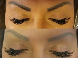 25+ grand tattooed eyebrows before and after. Microblading Removal Saline V S Laser Eyebrow Tattoo Removal