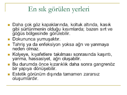 Duyu Organlari Hastaliklari Hastaliklarin Cesitleri Nedenleri Ve Tedavileri Ppt Indir
