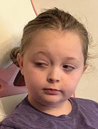 Beating stage 4 squamous cell carcinoma of the head and neck