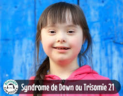 Également appelée syndrome de Down, la trisomie 21 résulte d'une anomalie  chromosomique. #Caryotype_normal Un caryotype normal contient 46  chromosomes classés en 23 paires dont 22 paires de chromosomes identiques  (deux à deux),