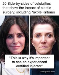 20 Side-by-sides of celebrities that show the impact of plastic surgery,  including Nicole Kidman (link in the comments)