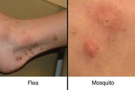 Image result for flea bite