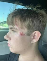 Heroic Act: Tanner Saves Child from Drowning