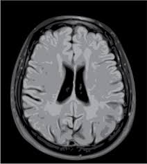 Image result for CT Head