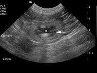 Understanding the importance of the test and the significance of the abnormal findings are often vital for effective mortality reduction. Diagnostic Imaging Ultrasound Of Cats With Chronic Renal Disease Not Always Black And White