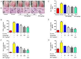 Baicalin Suppresses Propionibacterium Acnes Induced Skin Inflammation By Downregulating The Nf Kb Mapk Signaling Pathway And Inhibiting Activation Of Nlrp3 Inflammasome