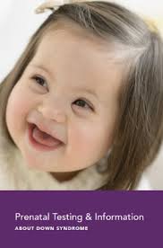 Global Down Syndrome Foundation, the National Down Syndrome Congress, and  the National Down Syndrome Society Highlight the FDA's Public Warning About  Risks Associated with Non-Invasive Prenatal Screening Tests