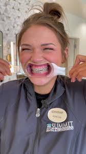 Light Violet Braces Color