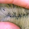 It is faster and easier if the infected area is kept shaven so the twice daily washing regime can penetrate effectively. 1