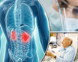 If your diagnosis is thyroid cancer, you may be able to breathe a bit easier, as it's one of the most treatable cancers when caugh. Best Laparoscopic Nephrectomy Cost India Kidney Cancer Surgery Hospitals India