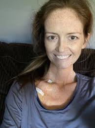 Surgery went well and my chest port is now in and I'm having a milkshake at  home. ☺️ My next step is getting the food IV bag (TPN) at home to help