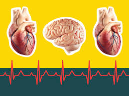 This means that your brain and vital organs are starved of oxygen; Cardiac Arrest Vs Heart Attack Vs Stroke Signs Symptoms And Causes Of Each Self