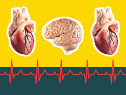 What's the difference between cardiac arrest vs heart attack? Cardiac Arrest Vs Heart Attack Vs Stroke Signs Symptoms And Causes Of Each Self