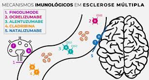 A tomografia computadorizada é um exame que serve para auxiliar o médico a fazer o diagnóstico de determinadas doenças, como por exemplo avc, aneurisma, câncer, alzheimer, parkinson, esclerose múltipla, epilepsia, meningite, entre outros. Esclerose Multipla Em