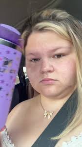 Wisdom Tooth Remove Anna